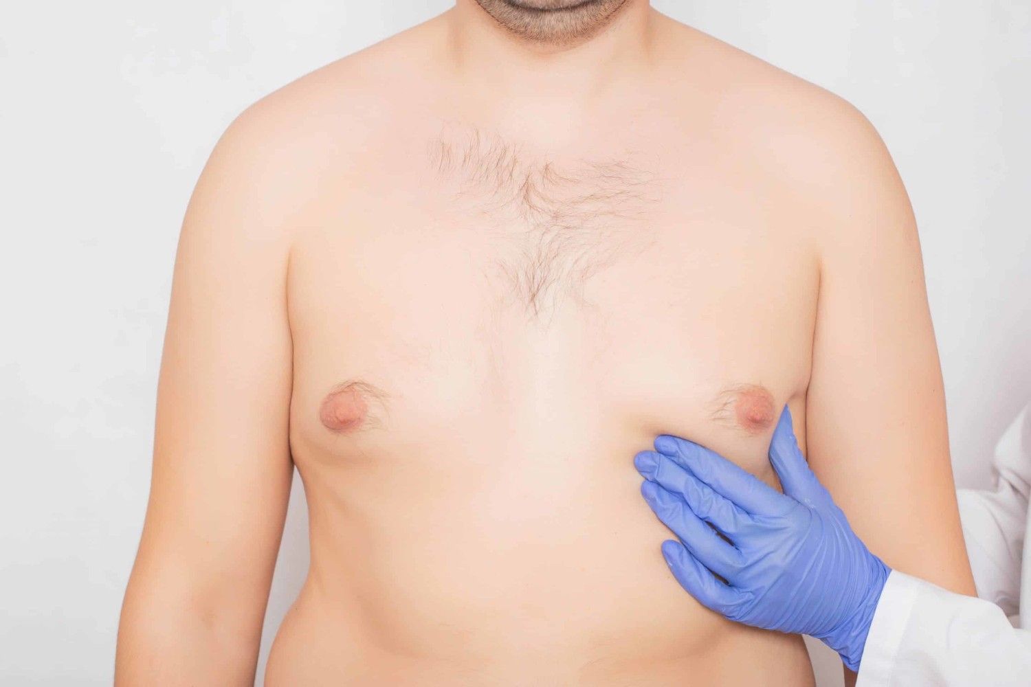 All You Need To Learn About The Gynecomastia Specialist Doctor
